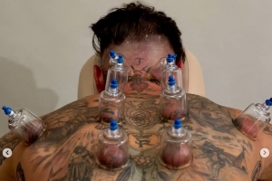 雷竞技专业-密密麻麻！39岁拉莫斯昨日踢满全场，今日脖子胳膊等多处都在拔罐